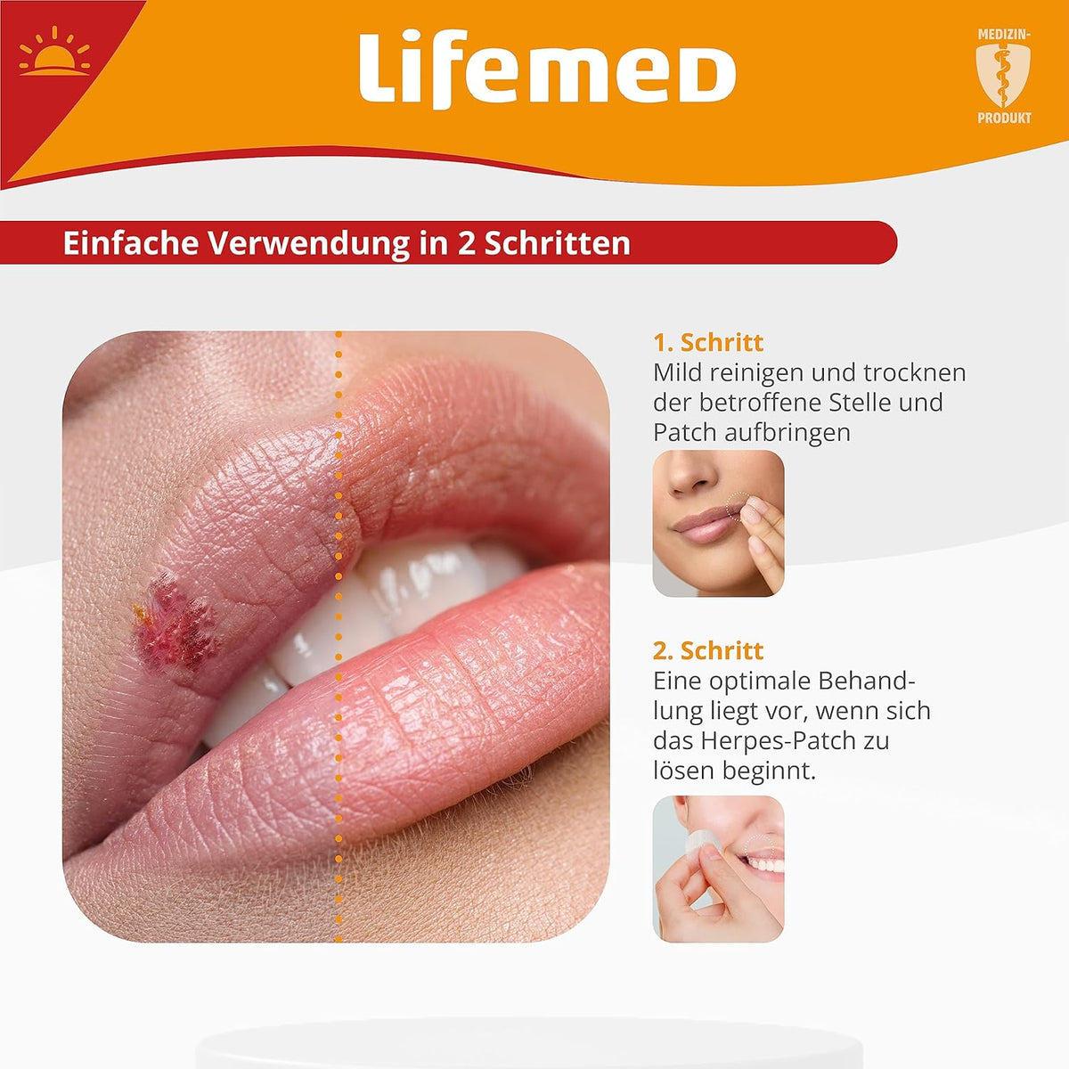 Infografik: Lifemed Herpes-Patches Anwendung in 2 Schritten – Lippenstelle reinigen, Patch aufbringen, bis es sich löst